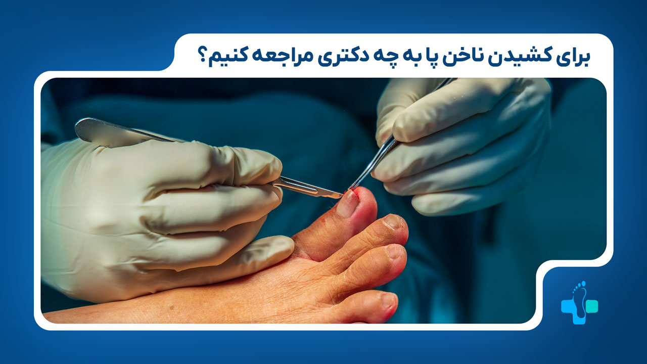 برای کشیدن ناخن به چه پزشکی مراجعه کنیم؟