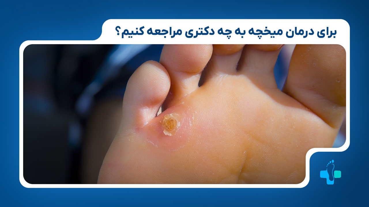 برای درمان میخچه به چه پزشکی مراجعه کنیم؟