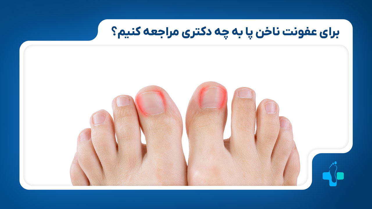 برای عفونت ناخن پا به پزشکی مراجعه کنیم؟