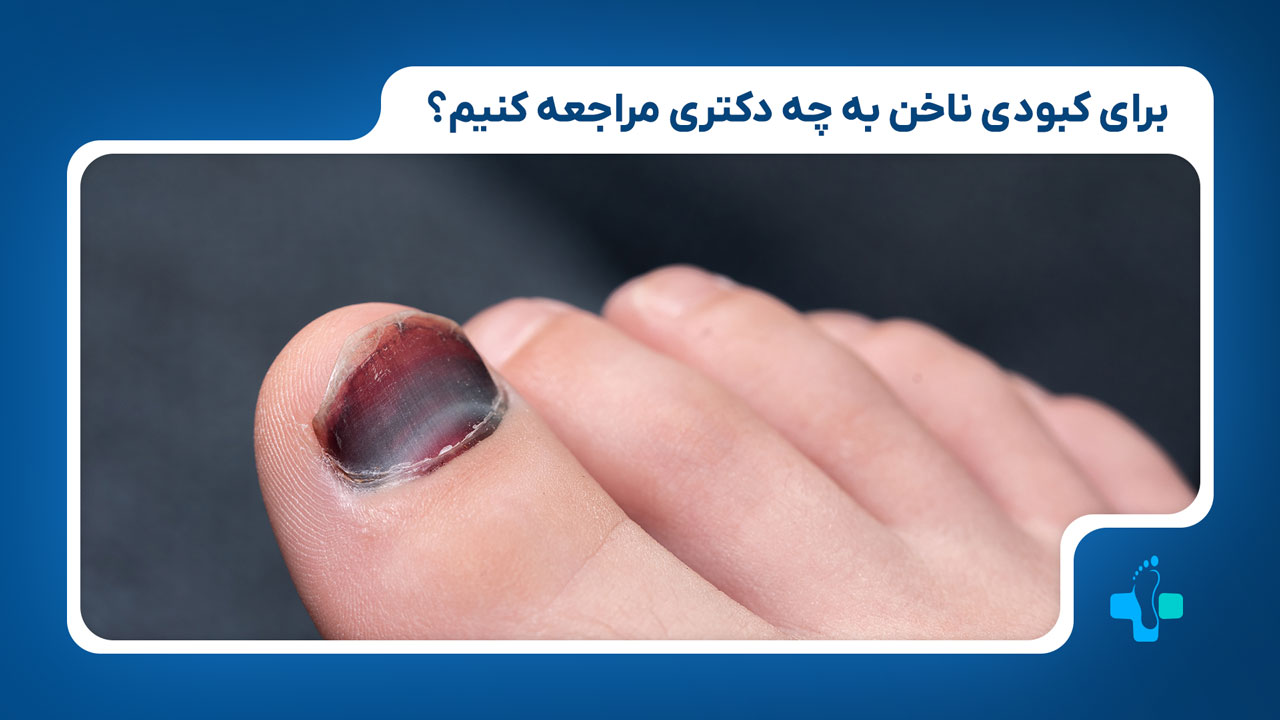 برای کبودی ناخن به چه پزشکی مراجعه کنیم؟
