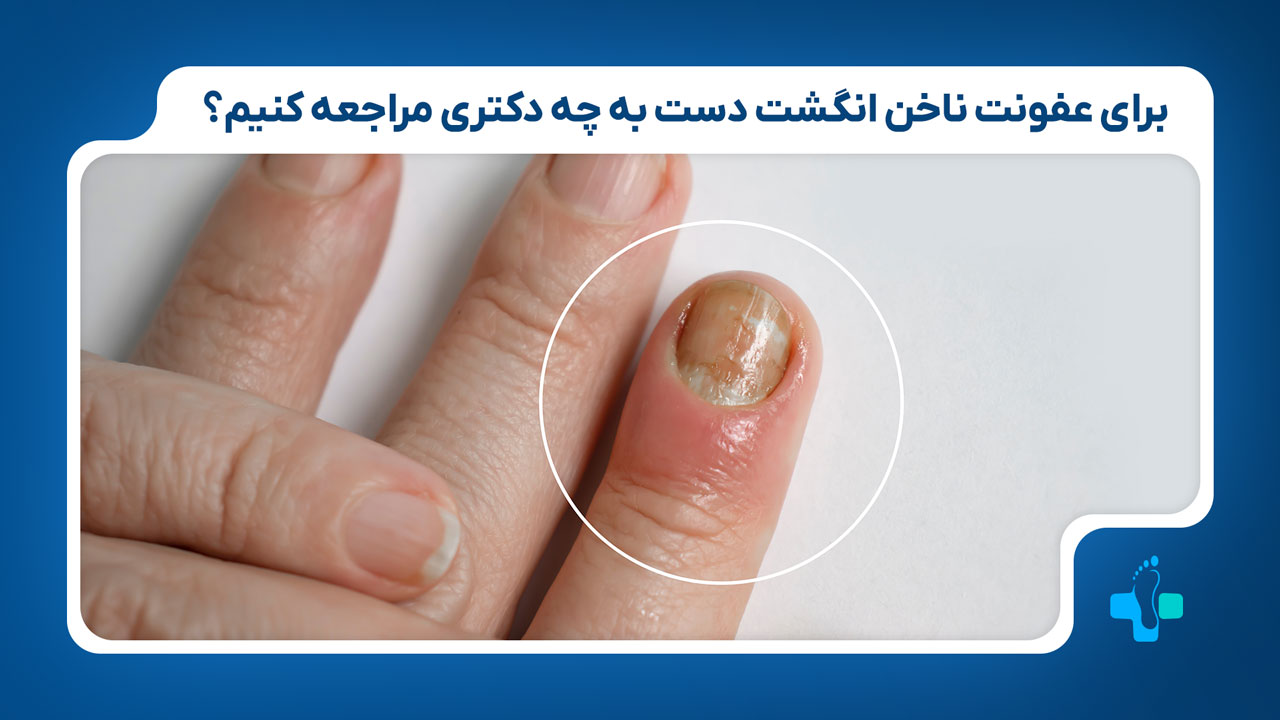 برای عفونت ناخن دست به چه پزشکی مراجعه کنیم؟