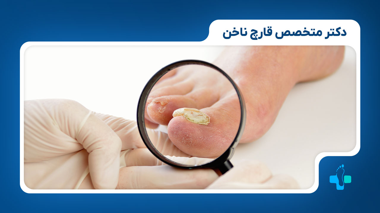 دکتر متخصص برای قارچ ناخن
