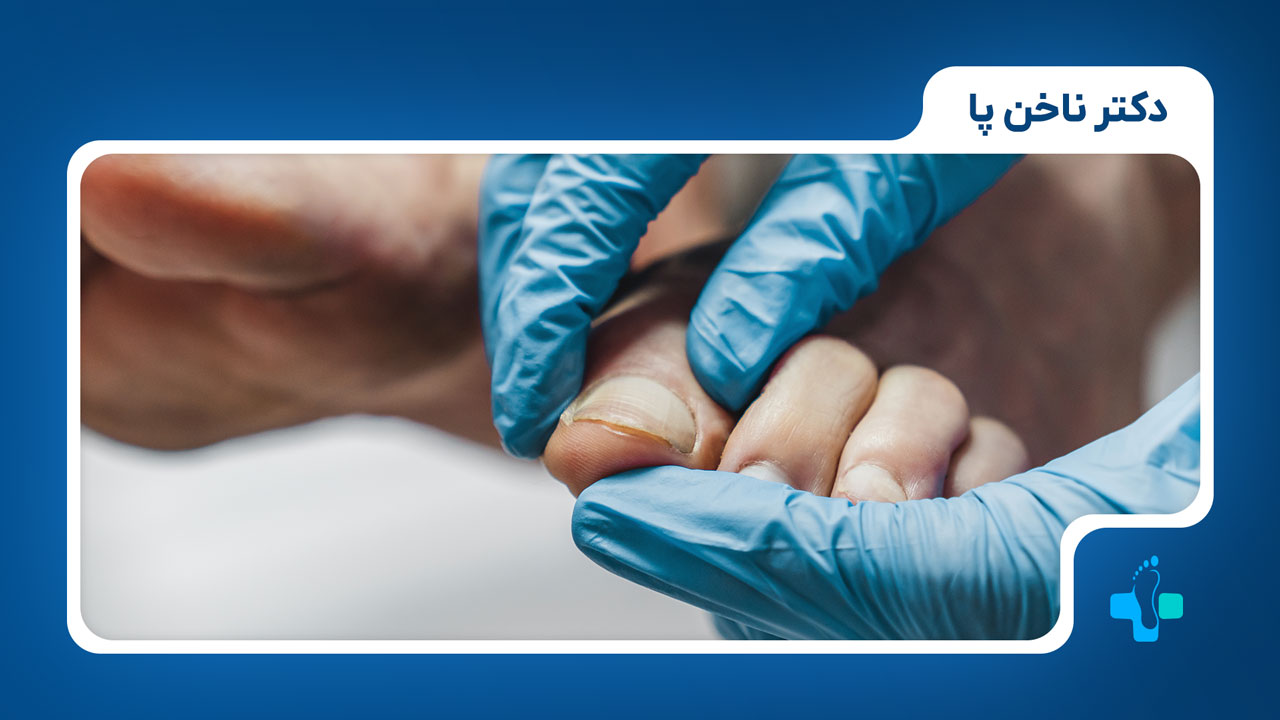 پزشک ناخن پا