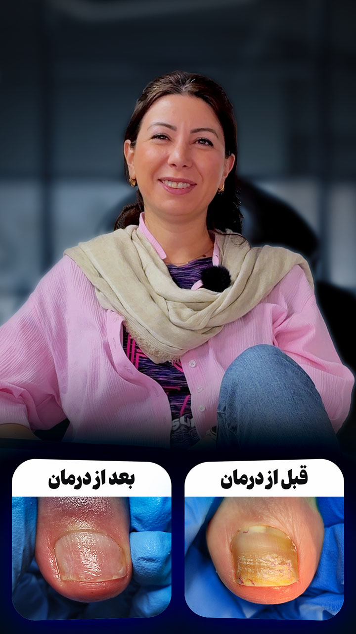 تنی یعقوبیان