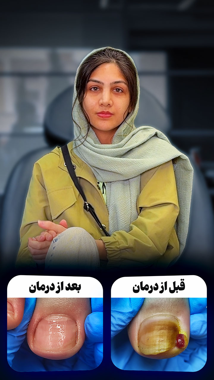 زهرا فتحی