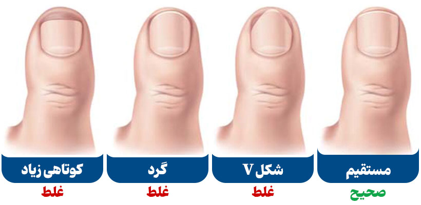 کوتاه کردن غیراصولی و اصولی ناخن به شکل های مختلف